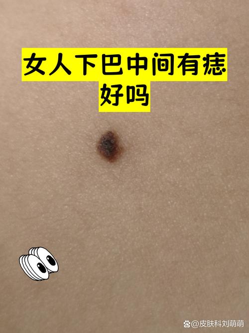 下巴中間長痣