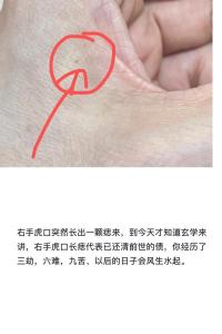 男人左手虎口有痣寓意