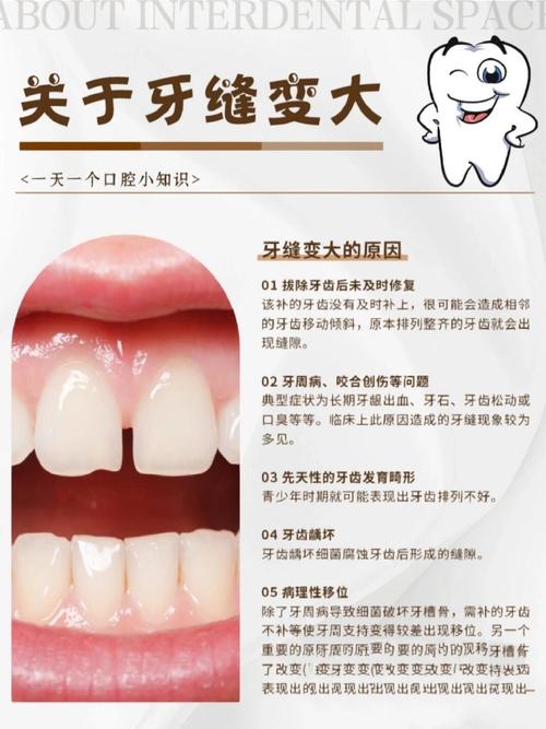 牙齒縫隙大好嗎