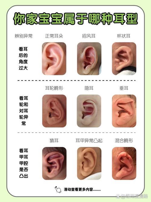 耳朵的分類有哪些