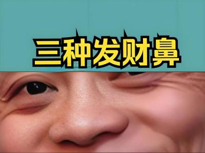看看富人們的鼻子都長啥樣