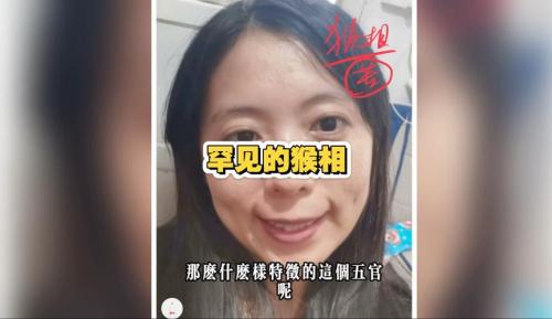 有猴眼的人面相分析